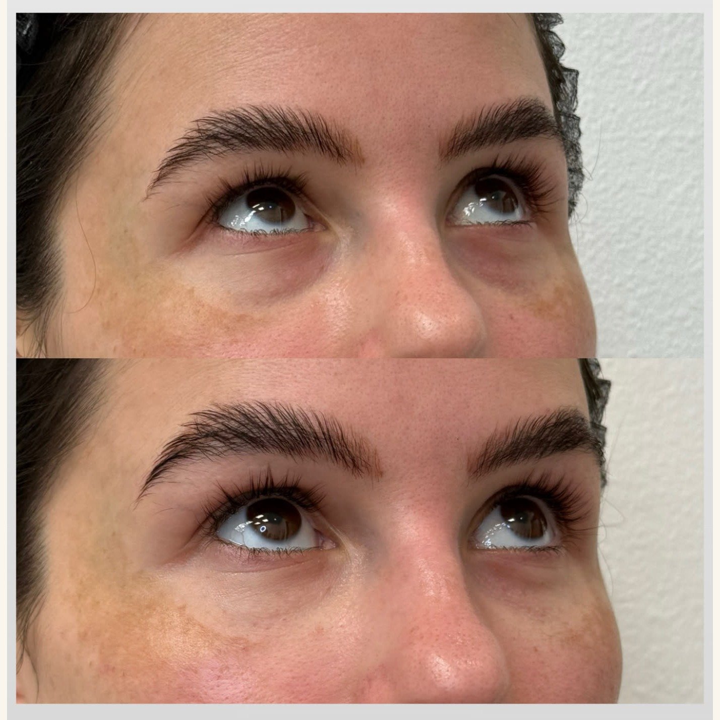 Before and after — Botox brow lift at Privé Aesthetics, Dallas. Subtle elevation of the lateral brow through precise neuromodulator placement by a Certified Aesthetic Nurse Specialist.