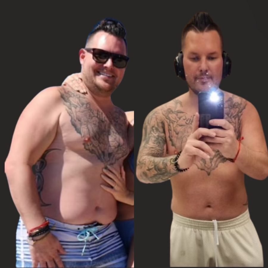 Before and after — weight loss and peptide therapy at Privé Aesthetics Dallas